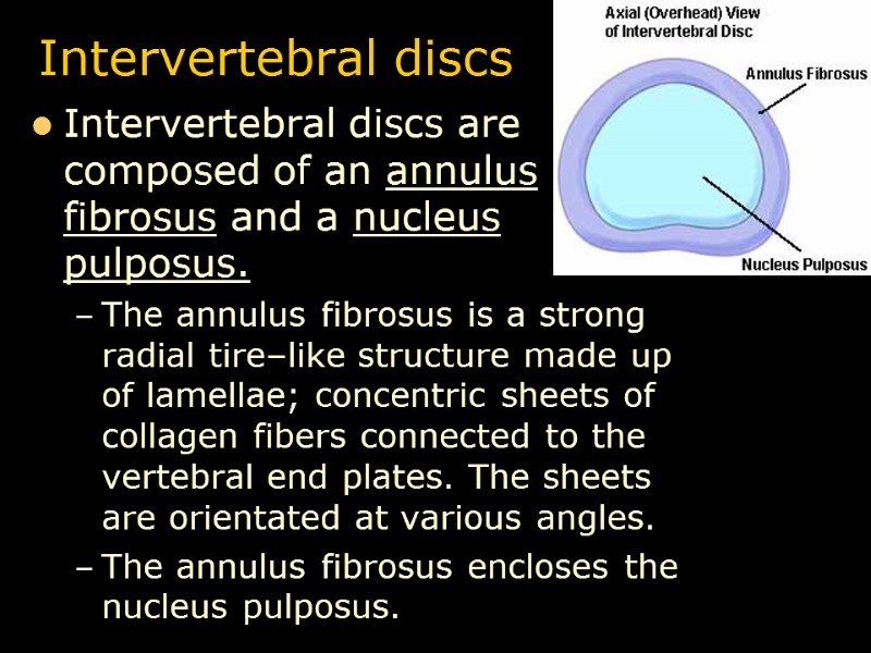 Intervertebral discs Intervertebral discs are composed of an annulus fibrosus and a nucleus pulposus.